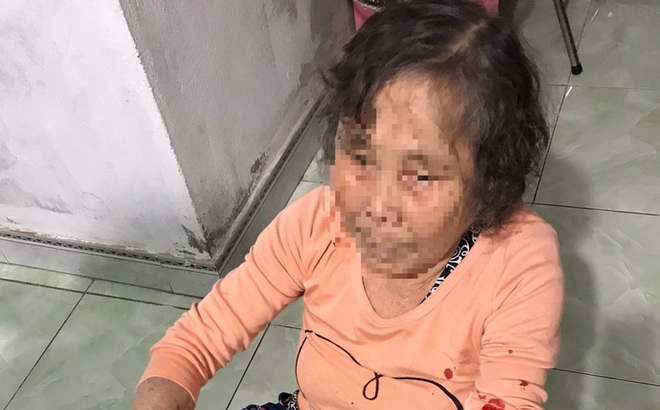 Thông tin mới vụ cụ bà 83 tuổi bị đánh nhập viện vì nhắc hàng xóm bật