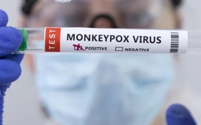 Virus gây bệnh đậu mùa khỉ đã xuất hiện ở trên 20 quốc gia.