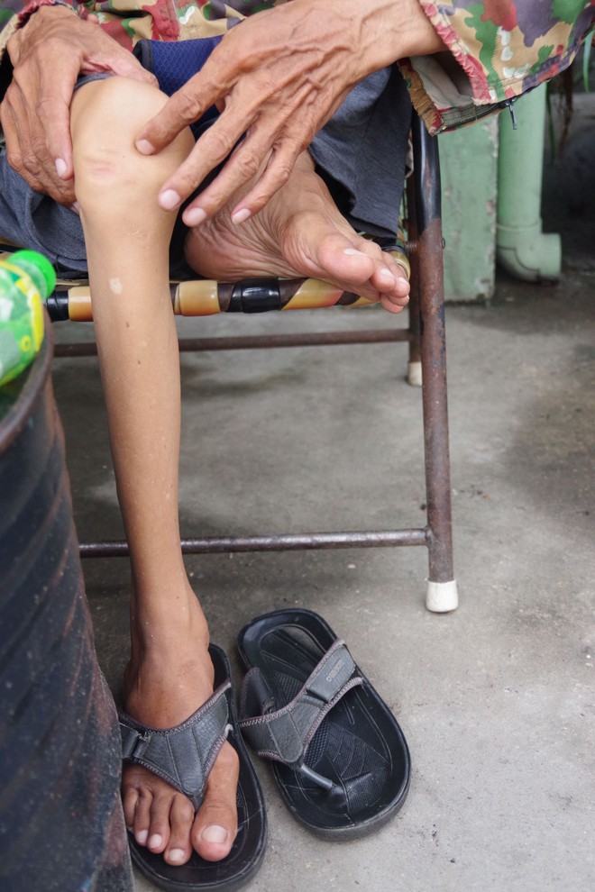 Người đàn ông bị liệt vẫn miệt mài làm shipper ở Sài Gòn: 'Tôi không muốn vừa tàn vừa phế' - Ảnh 2