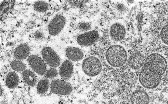 Hình ảnh virus đậu mùa khỉ dưới kính hiển vi. Ảnh: AFP/TTXVN
