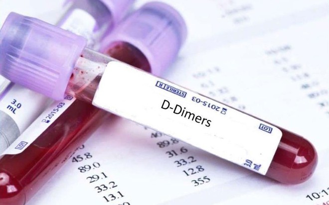 Xét nghiệm D-Dimers (ảnh minh họa).