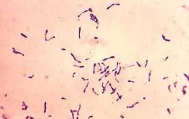 Vi khuẩn Corynebacterium diphtheriae gây ra bệnh bạch hầu (ảnh minh họa).