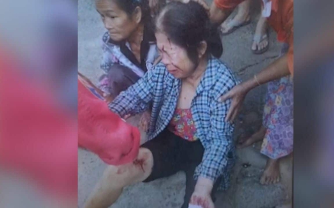 Nạn nhân đau đớn khóc ngất tại hiện trường sau sự cố. 