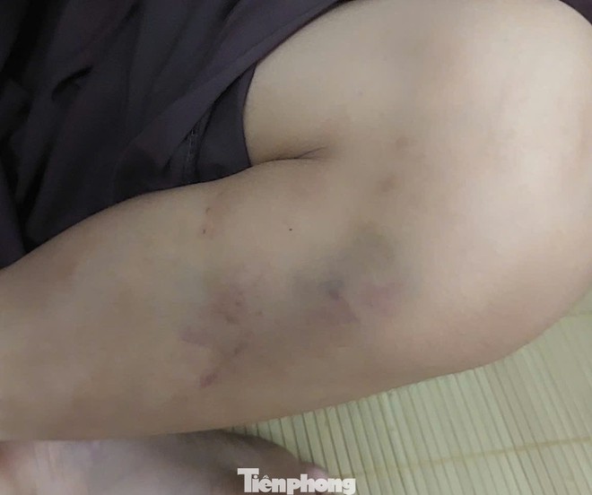 Vụ bạo hành trẻ tại chùa Bầu, Phú Thọ: Nhiều cháu có thương tích - Ảnh 1.