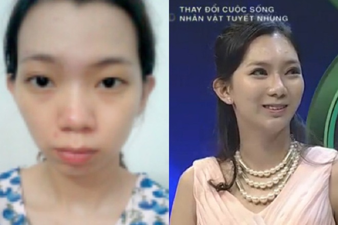 Sự thay đổi tuyệt vời sau 3 tháng của cô gái Nam Định - Ảnh 1.