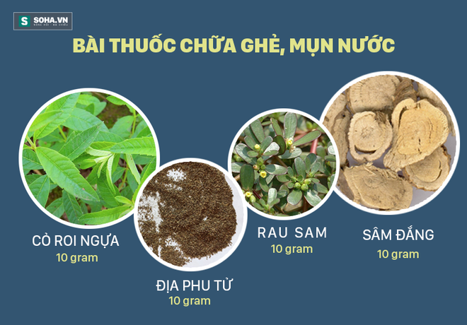 Bài thuốc đặc trị dành cho người chết khổ vì bệnh ghẻ, mụn nước - Ảnh 3.