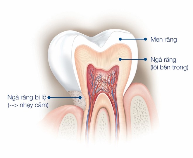 Răng nhạy cảm: Vấn đề đáng báo động - Ảnh 2.