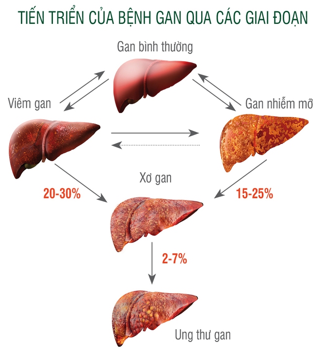 Biết mình bị ung thư gan, xin đừng nằm chờ chết - Ảnh 2.