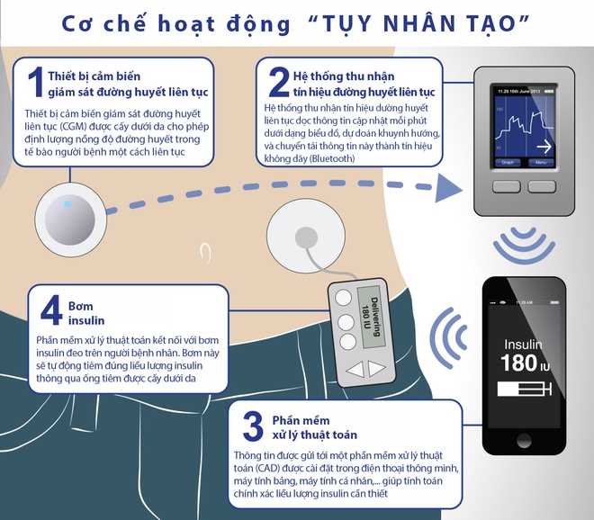 Sau suốt 10 năm nghiên cứu, Mỹ sắp cho ra đời TUYẾN TỤY NHÂN TẠO đầu tiên - Ảnh 2.