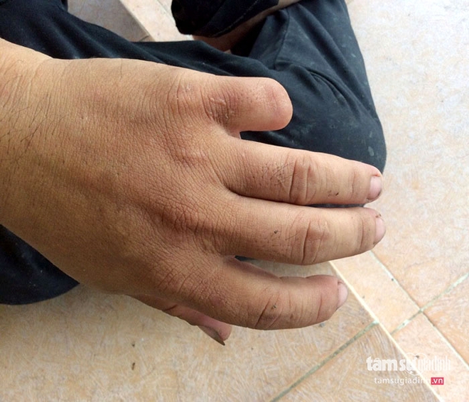 Bi kịch những gói quà đẫm máu gửi về từ sòng bạc Campuchia: Tiết lộ của con bạc bị chặt ngón tay (Kỳ 3) - Ảnh 1.