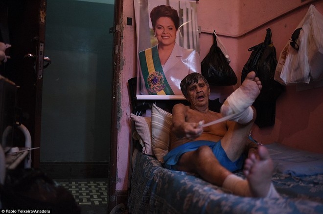 Ám ảnh cuộc sống bên trong trại trập trung bệnh nhân phong ở Brazil - Ảnh 4.