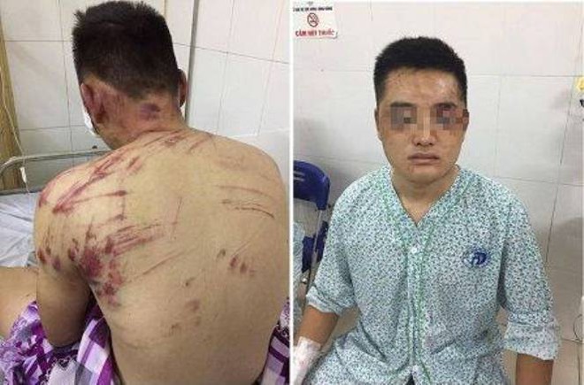 Côn đồ hành hung dã man lúc nửa đêm, 4 người ở Hà Nội nhập viện - Ảnh 1.