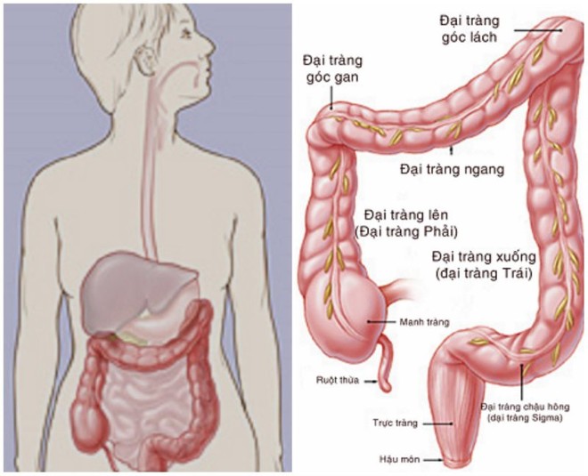 Ung thư vì bỏ qua triệu chứng suốt 10 năm: Bác sĩ chỉ rõ 3 dấu hiệu chớ coi thường - Ảnh 4.