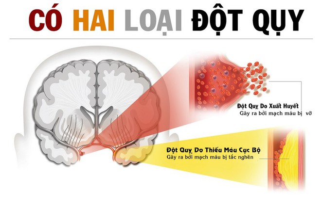 Ngay cả khi còn trẻ, hãy làm ngay 3 điều sau để phòng tránh cái chết đột ngột - Ảnh 2.