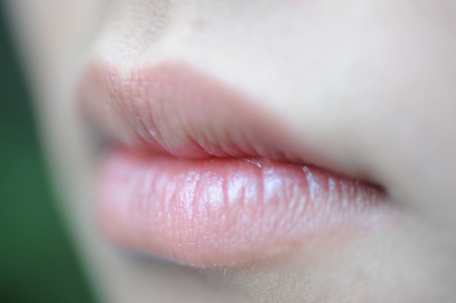 Đôi môi là cửa sổ của sức khỏe: Hãy xem môi bạn cảnh báo bệnh gì để khắc phục sớm - Ảnh 1.