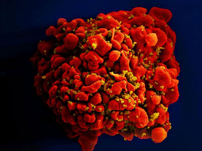 Ca nhiễm HIV thứ 3 trên thế giới được chữa khỏi - Ảnh 1.