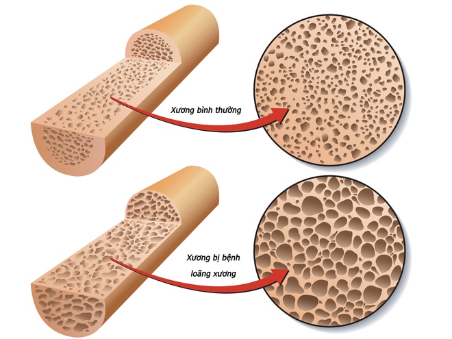 7 công thức sức khỏe: Công thức số 1 của chuyên gia kinh tế Mỹ khiến nhiều người tỉnh ngộ! - Ảnh 6.