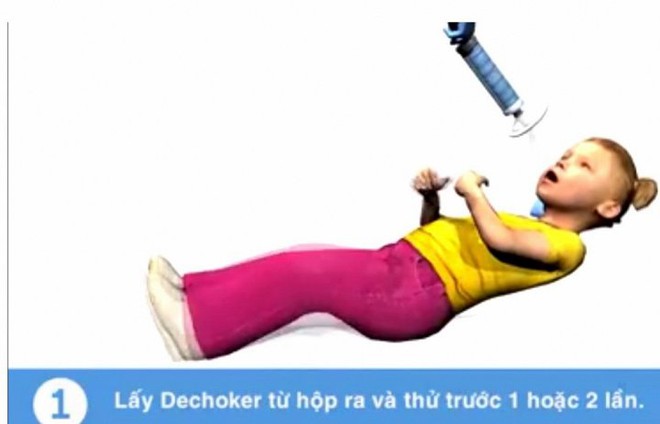 Tử vong do sặc cháo: Nếu biết cách cấp cứu kịp thời có thể cứu mạng trẻ - Ảnh 2.