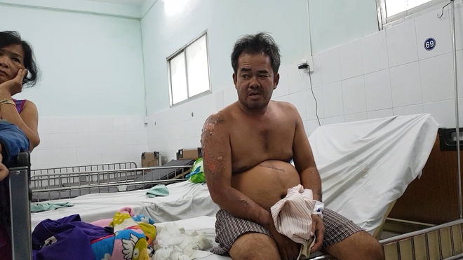 Vụ hỏa hoạn khiến 6 người thương vong ở Sài Gòn: Bé 10 tháng tuổi may mắn được cứu sống sau khi mẹ quấn áo ướt đặt ở góc phòng tắm - Ảnh 2.