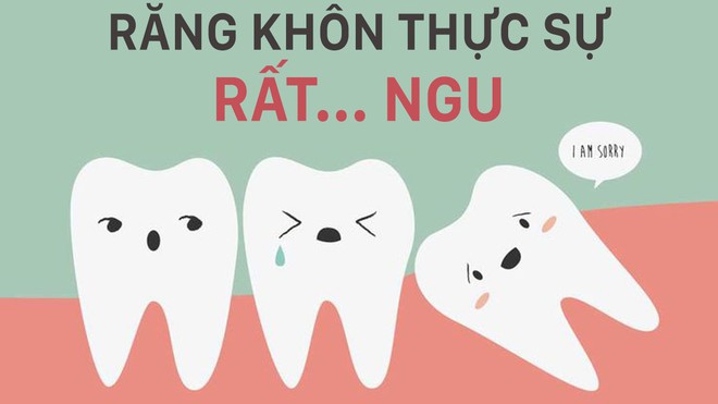 Nỗi niềm mọc răng khôn: Chỉ những người trong cuộc mới hiểu được cảm giác phát điên - Ảnh 2.