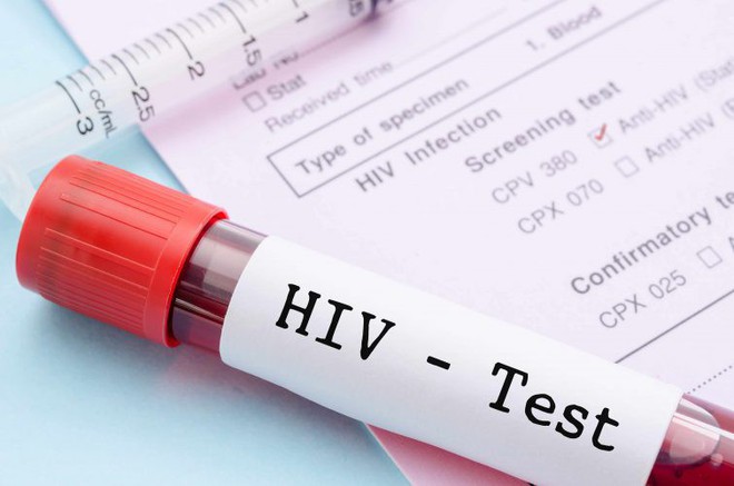 10 sai lầm không ai ngờ về căn bệnh thế kỷ HIV/AIDS - Ảnh 1.