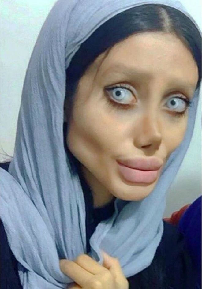 Cô gái phẫu thuật thẩm mỹ hơn 50 lần để nhìn giống Angelina Jolie, kết quả trả về gia tinh Dobby - Ảnh 3.