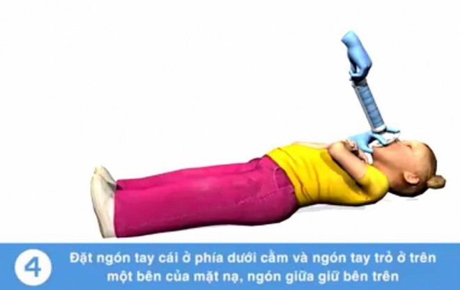 Tử vong do sặc cháo: Nếu biết cách cấp cứu kịp thời có thể cứu mạng trẻ - Ảnh 5.