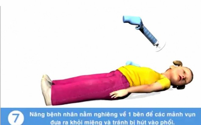 Tử vong do sặc cháo: Nếu biết cách cấp cứu kịp thời có thể cứu mạng trẻ - Ảnh 8.