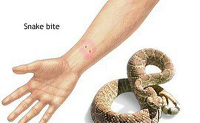 Kết quả hình ảnh cho VẾT RẮN CẮN