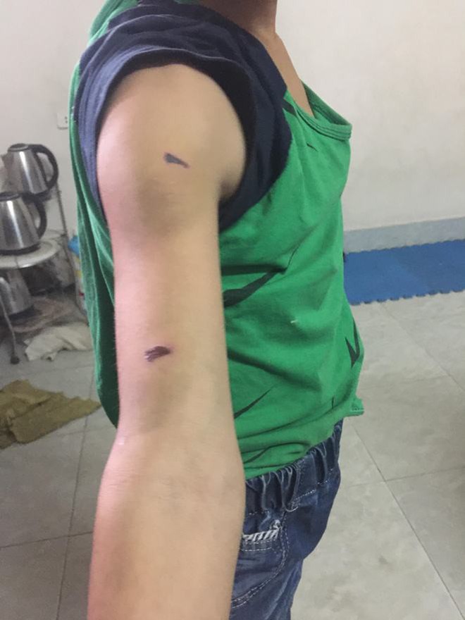 Bé trai học lớp 4 ở Hà Nội tố bị bố đẻ dùng dây điện đánh dã man - Ảnh 2.