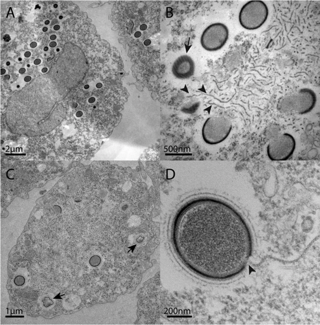 Khoa học cảnh báo: Nóng lên toàn cầu có thể khiến virus gây bệnh đội mồ sống dậy - Ảnh 3.