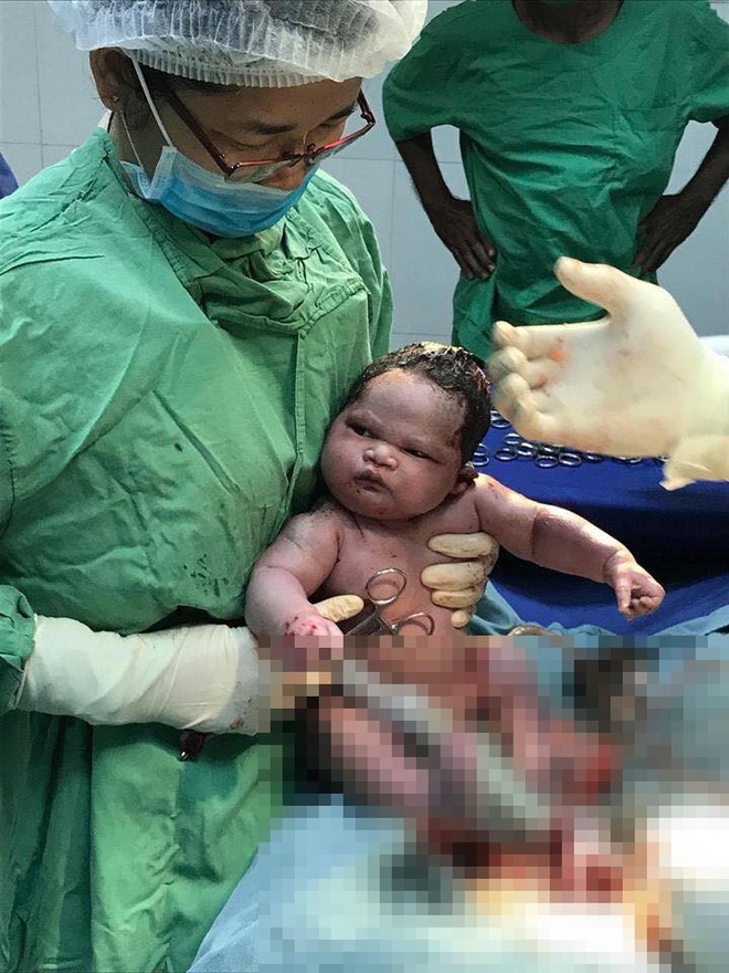 Biểu cảm khi mới chào đời của em bé gây sốt mạng xã hội: Không dám nhìn vào đôi mắt ấy - Ảnh 2. Biểu cảm khi mới chào đời của em bé gây sốt mạng xã hội: Không dám nhìn vào đôi mắt ấy - Ảnh 2.