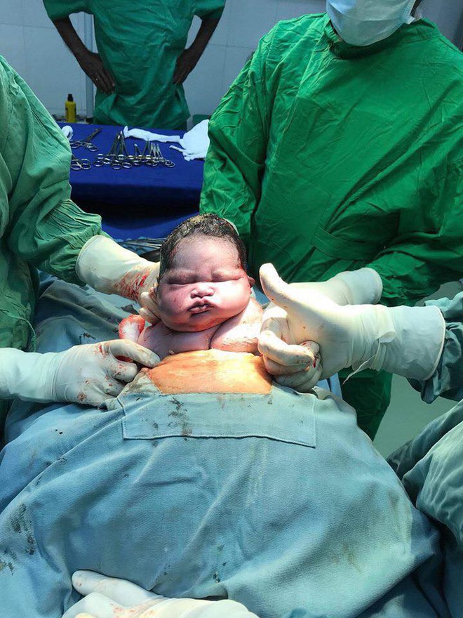 Biểu cảm khi mới chào đời của em bé gây sốt mạng xã hội: Không dám nhìn vào đôi mắt ấy - Ảnh 1. Biểu cảm khi mới chào đời của em bé gây sốt mạng xã hội: Không dám nhìn vào đôi mắt ấy - Ảnh 1.