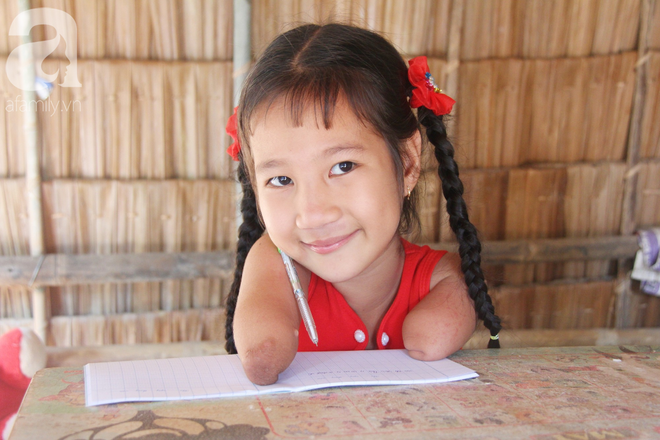 Bố mất, mẹ bỏ đi lấy chồng, bé gái 8 tuổi ngây ngô hỏi: Ngoại ơi, sao mẹ sinh con ra cụt tay cụt chân vậy ạ? - Ảnh 14.