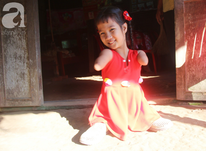 Bố mất, mẹ bỏ đi lấy chồng, bé gái 8 tuổi ngây ngô hỏi: Ngoại ơi, sao mẹ sinh con ra cụt tay cụt chân vậy ạ? - Ảnh 16.