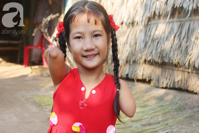 Bố mất, mẹ bỏ đi lấy chồng, bé gái 8 tuổi ngây ngô hỏi: Ngoại ơi, sao mẹ sinh con ra cụt tay cụt chân vậy ạ? - Ảnh 9.