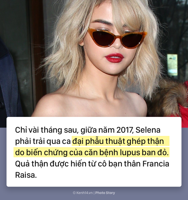 Selena Gomez và hành trình 5 năm chống chọi với căn bệnh lupus ban đỏ kèm di chứng - Ảnh 3.