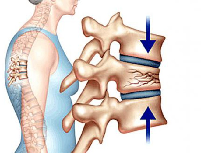 Sau tuổi 40, nam giới phải đối mặt với 7 căn bệnh không mời mà đến: Bạn nên bảo trọng! - Ảnh 3.