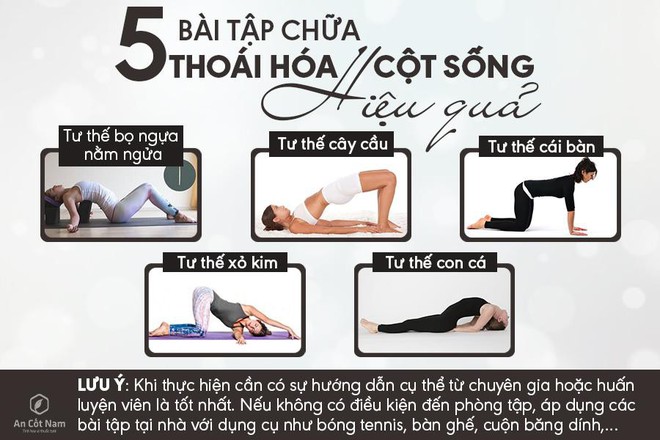 Thoái hóa cột sống là gì? Nguyên nhân, triệu chứng và cách chữa dứt điểm - Ảnh 3.