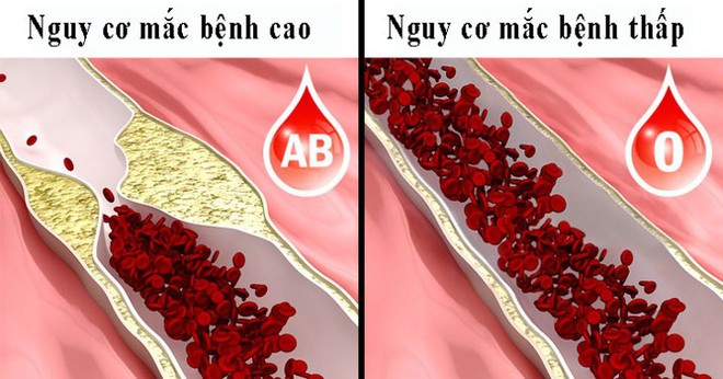 8 điều người nhóm máu O nên biết - Ảnh 6.