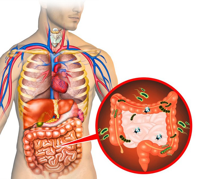 Thải độc ngay lập tức nếu bạn gặp phải 10 dấu hiệu này - Ảnh 8.