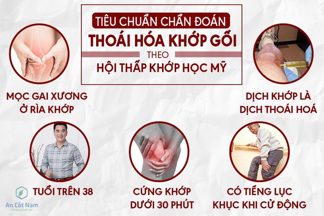 Thoái hóa khớp gối: Nguyên nhân, triệu chứng và cách chữa viêm đau khớp gối - Ảnh 2.