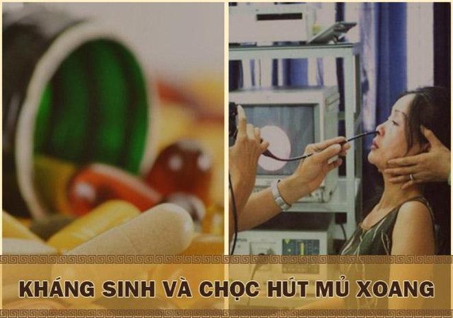 Viêm xoang hàm mãn tính có thể chữa khỏi được nhờ bài thuốc nam này - Ảnh 2.