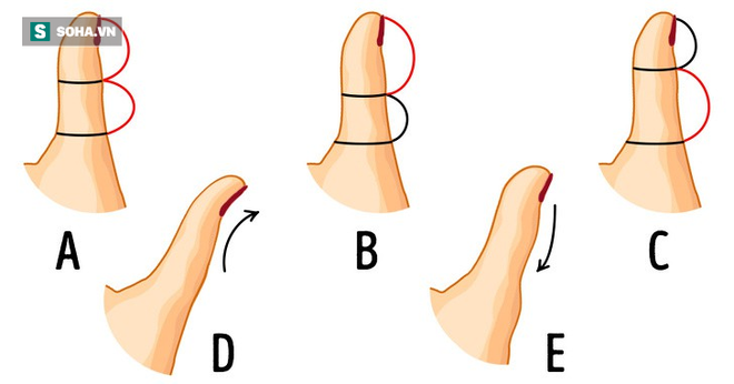 Nhìn hình dáng ngón tay cái, đọc vị khả năng thành công của mỗi người - Ảnh 1.