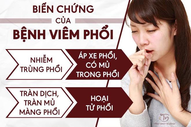 Viêm phổi là gì? Nguyên nhân và cách chữa viêm phổi cấp, thùy, kẽ - Ảnh 2.