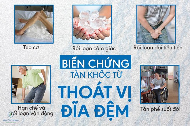 Thoát vị đĩa đệm là gì? Nguyên nhân, triệu chứng và cách điều trị - Ảnh 1.