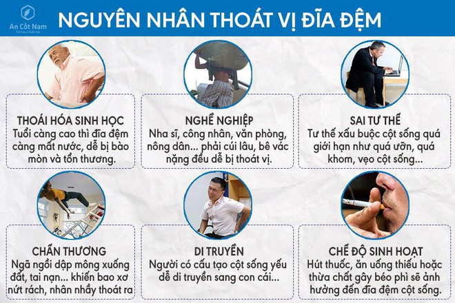 Thoát vị đĩa đệm là gì? Nguyên nhân, triệu chứng và cách điều trị - Ảnh 2.