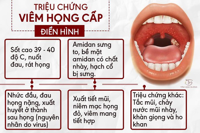 Viêm họng là gì? Cách chữa bệnh viêm họng hạt, cấp và mãn tính - Ảnh 1.