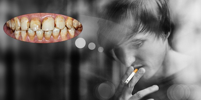 90% người Việt sâu răng, viêm lợi, mất răng... do thói quen sai lầm này: Bạn có mắc phải? - Ảnh 2.