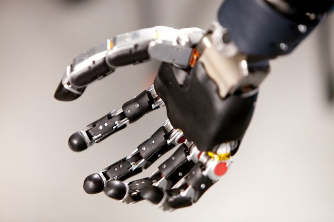 Người đàn ông đầu tiên trên thế giới sống với cánh tay robot điều khiển bằng trí não - Ảnh 2.